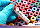 Kasus Campak di Indonesia Naik Drastis: Penyakit Ini 18 Kali Lebih Menular dari COVID-19