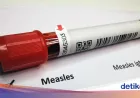 Kemenkes Ingatkan Stop Sentuh Bayi Saat Lebaran, Waspadai Penularan Campak
