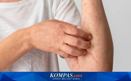 Campak Bukan Penyakit Ringan: IDAI Tegaskan Pentingnya Imunisasi Lengkap Sebelum Mudik