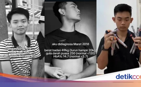 Diabetes Tipe 1 pada Pria 23 Tahun di Denpasar: Dokter Jelaskan Pemicu Utama