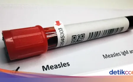 Kemenkes Ingatkan Stop Sentuh Bayi Saat Lebaran, Waspadai Penularan Campak
