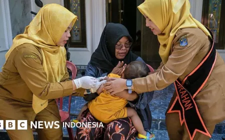 Kasus Campak Melonjak di Indonesia: Dampak Nyata Narasi Antivaksin dan Penurunan Imunisasi