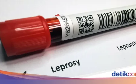 Kasus Kusta Indonesia Juara 3 Dunia: Stigma Jadi Penghambat Pengobatan
