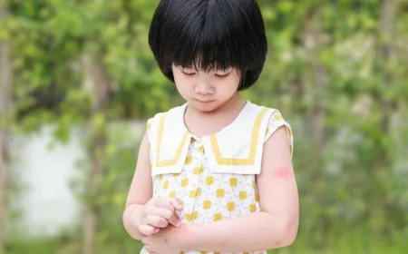 Campak Mudah Menular pada Anak: Virus Bertahan di Udara Lebih dari 2 Jam