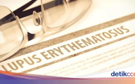 Penyakit Lupus: Gejala, Jenis, dan Cara Penanganan yang Perlu Diketahui
