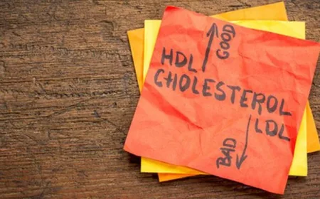 5 Cara Ampuh Cegah Kolesterol Naik Setelah Makan Opor Ayam dan Rendang