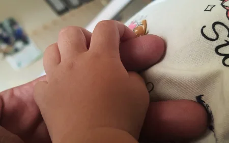 Waspada Penyakit Campak pada Balita Saat Liburan Idulfitri 1447 H