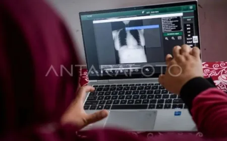 Dinkes Kota Madiun Tingkatkan Deteksi Kasus Baru Penyakit TBC Demi Target Eliminasi 2030