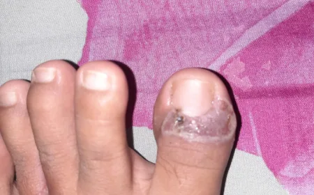 Salap untuk Penyakit Kulit: Solusi Ampuh Atasi Sakit dan Gatal di Kaki