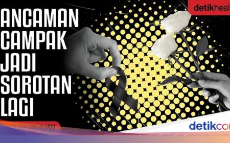 Dokter Muda di Cianjur Meninggal Diduga Campak, Pakar Soroti Komplikasi Pneumonia