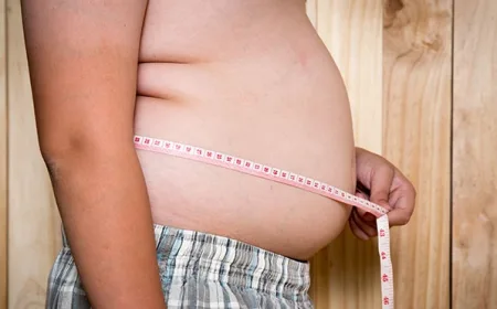 Obesitas Meningkat Jadi 23,4% di 2023: Penting Pahami Sebagai Penyakit Kronis