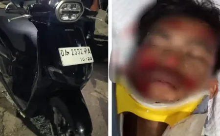 Kecelakaan di Km 33 Banjarbaru: Pengendara Motor Alami Luka Parah, Identitas Belum Diketahui