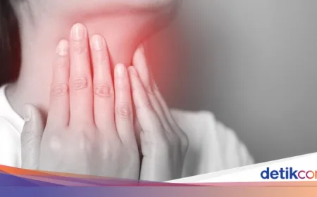 Akalasia: Penyakit Langka yang Bikin Wanita Tasikmalaya Harus Makan Lewat Selang