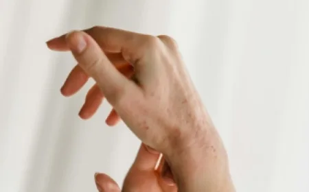 Kematian Dokter Muda Akibat Campak: Waspadai Bahaya Penyakit Ini pada Dewasa