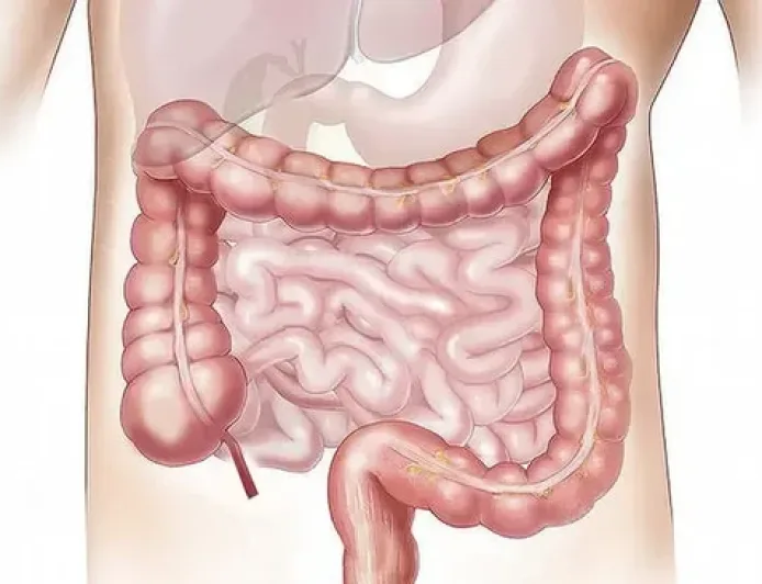 Kanker Usus Besar Meningkat Drastis pada Anak Muda, Ini Fakta Terbarunya