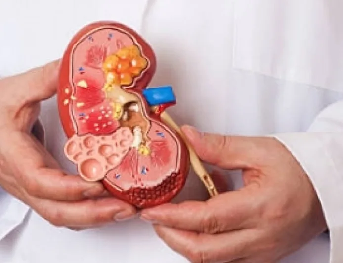 Deteksi Dini dan Kebijakan Ramah Lingkungan: Kunci Atasi Penyakit Ginjal di Indonesia