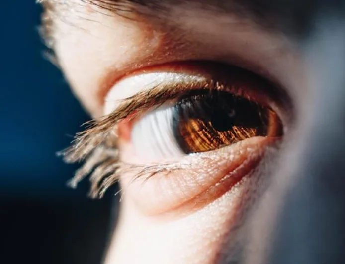 5 Gejala Kerusakan Ginjal yang Terlihat dari Mata, Segera Cek!