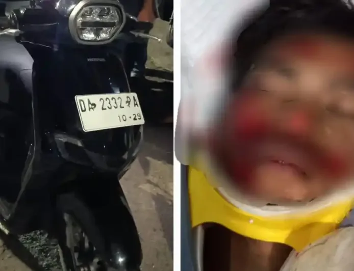 Kecelakaan di Km 33 Banjarbaru: Pengendara Motor Alami Luka Parah, Identitas Belum Diketahui