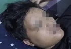 Pemuda Tanjungsari Jadi Korban Penganiayaan, Motor Dirusak dan Trauma Berat