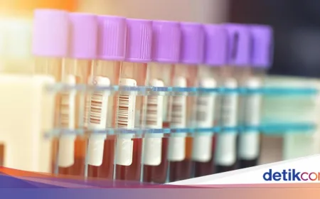 Mpox Kembali Muncul di Singapura: 2 Kasus Varian Clade 1b yang Lebih Berbahaya