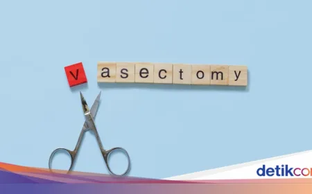 Vasektomi dan Mitos Sperma Menumpuk: Urolog Jelaskan Fakta Penting