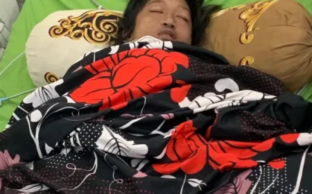 Yulita Remaja Asal Mitem Mengidap Lupus Nefritis, Butuh Bantuan Dermawan Segera