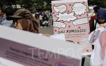 Rem Alami Peradangan Kulit Ditemukan di Amerika, Terobosan Terapi Psoriasis dan Eksim