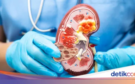Kasus Gagal Ginjal di Malaysia Meningkat Drastis: Ini Pemicunya dan Dampaknya
