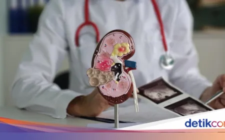 Kasus Gagal Ginjal di Indonesia Meningkat Drastis, Warga +62 Makin Banyak Cuci Darah