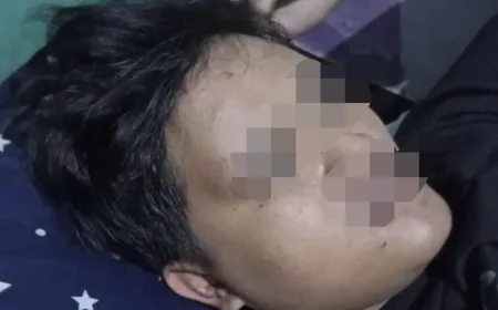 Pemuda Tanjungsari Jadi Korban Penganiayaan, Motor Dirusak dan Trauma Berat
