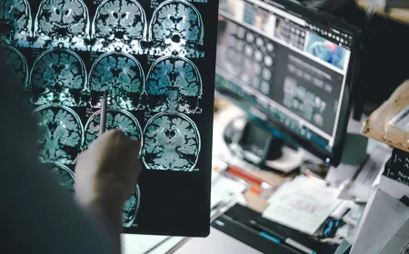 Peran Sistem Pencernaan dalam Risiko Alzheimer: Temuan Studi Terbaru