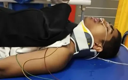 Hafizh Aceh Zaghlul Ammar Alami Kecelakaan Serius Menuju Pesantren Thursina Malang