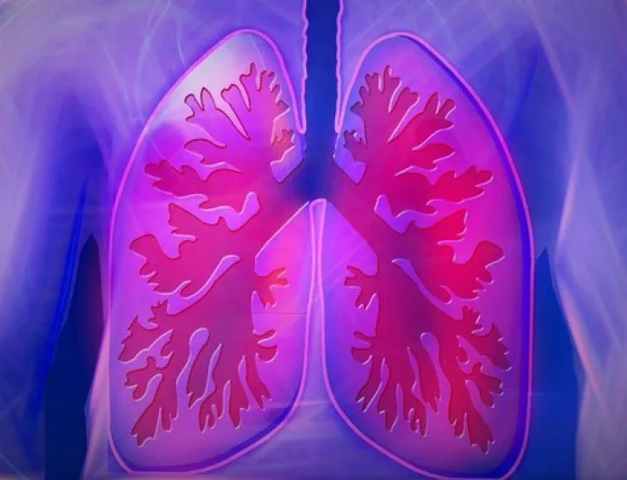 Gejala Kanker Paru yang Sering Diabaikan: Batuk Berkepanjangan Wajib Diwaspadai