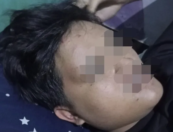 Pemuda Tanjungsari Jadi Korban Penganiayaan, Motor Dirusak dan Trauma Berat