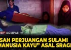 Kisah Sulami Manusia Kayu Asal Sragen Lawan Penyakit Langka Jadi Sorotan Dunia