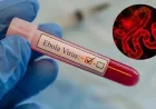 Pantau ketat penyakit virus Ebola dan cegah masuknya ke Vietnam.