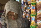 Lupus Penyakit Autoimun Kronis Banyak Serang Wanita, Ini Kata Dokter