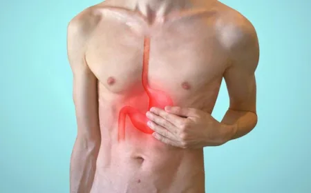 Dokter Ungkap Kesalahan Ini Bikin GERD/Asam Lambung Sering Naik