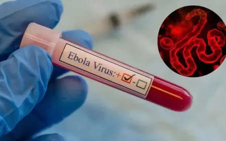 Pantau ketat penyakit virus Ebola dan cegah masuknya ke Vietnam.