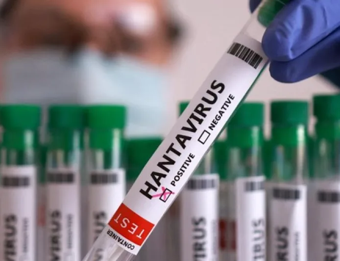 Hantavirus Sudah Masuk RI, 23 Kasus Terdeteksi dan 3 Meninggal