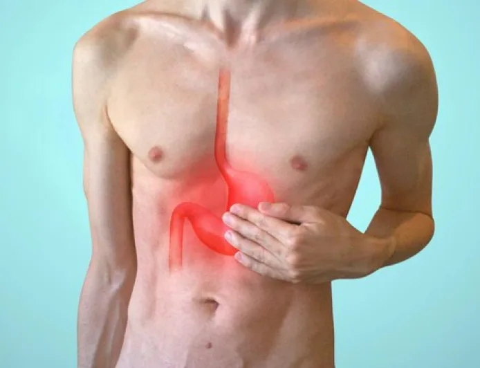 Dokter Ungkap Kesalahan Ini Bikin GERD/Asam Lambung Sering Naik