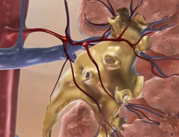 Yang perlu Anda ketahui jika Anda berusia di atas 40 tahun: Tanda-tanda peringatan gagal ginjal yang mudah terlewatkan.