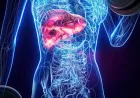 Usia 30-an Banyak Kena Fatty Liver, Waspada Silent Killer