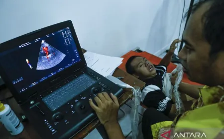 Infeksi jantung pada anak berisiko memicu komplikasi