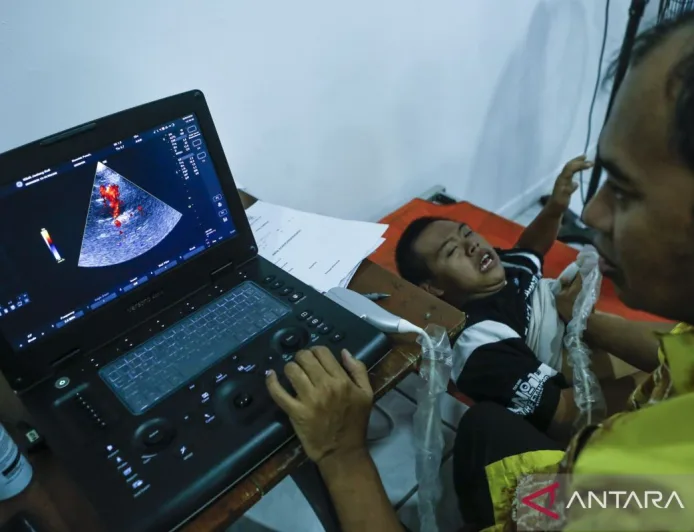 Infeksi jantung pada anak berisiko memicu komplikasi